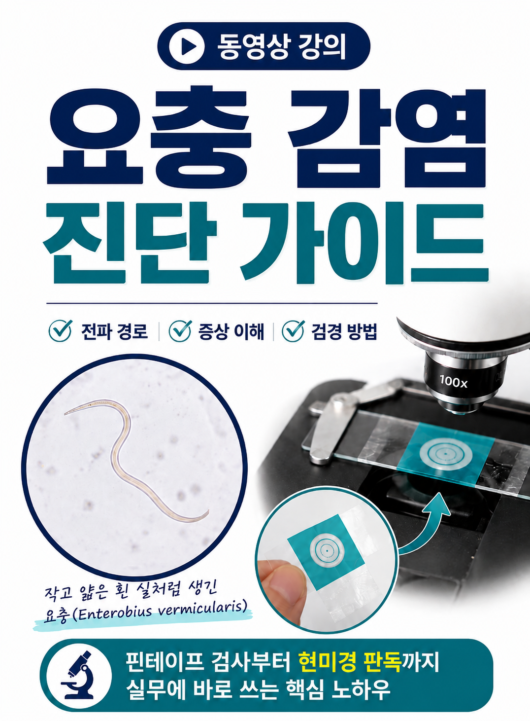 요충 감염 진단 가이드
