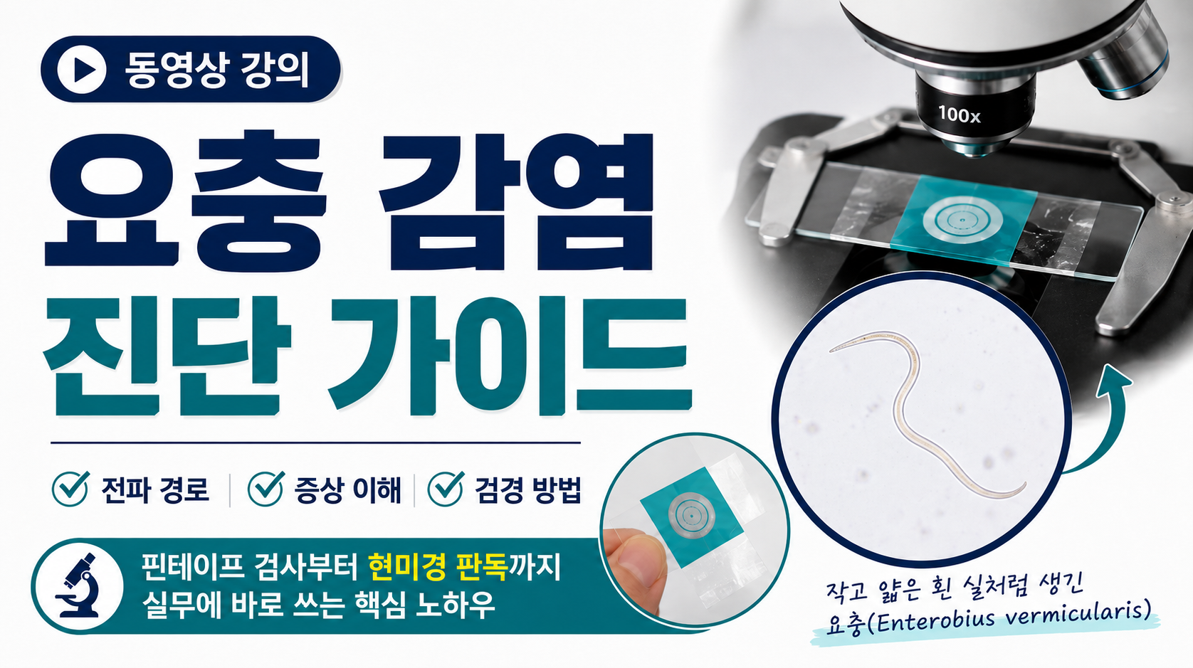 요충 감염 진단 가이드