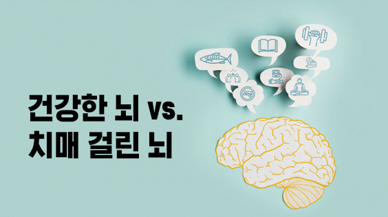 건강한 뇌 vs. 치매 걸린 뇌 (강의교안)